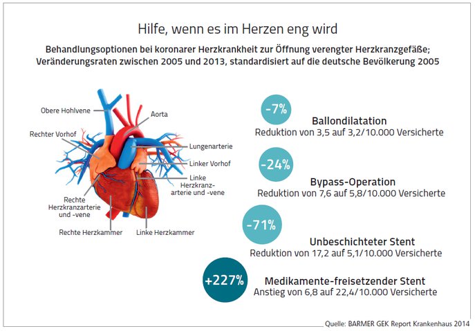 BARMER GEK Report Krankenhaus 2014 Behandlungsoptionen bei koronarer Herzkrankheit